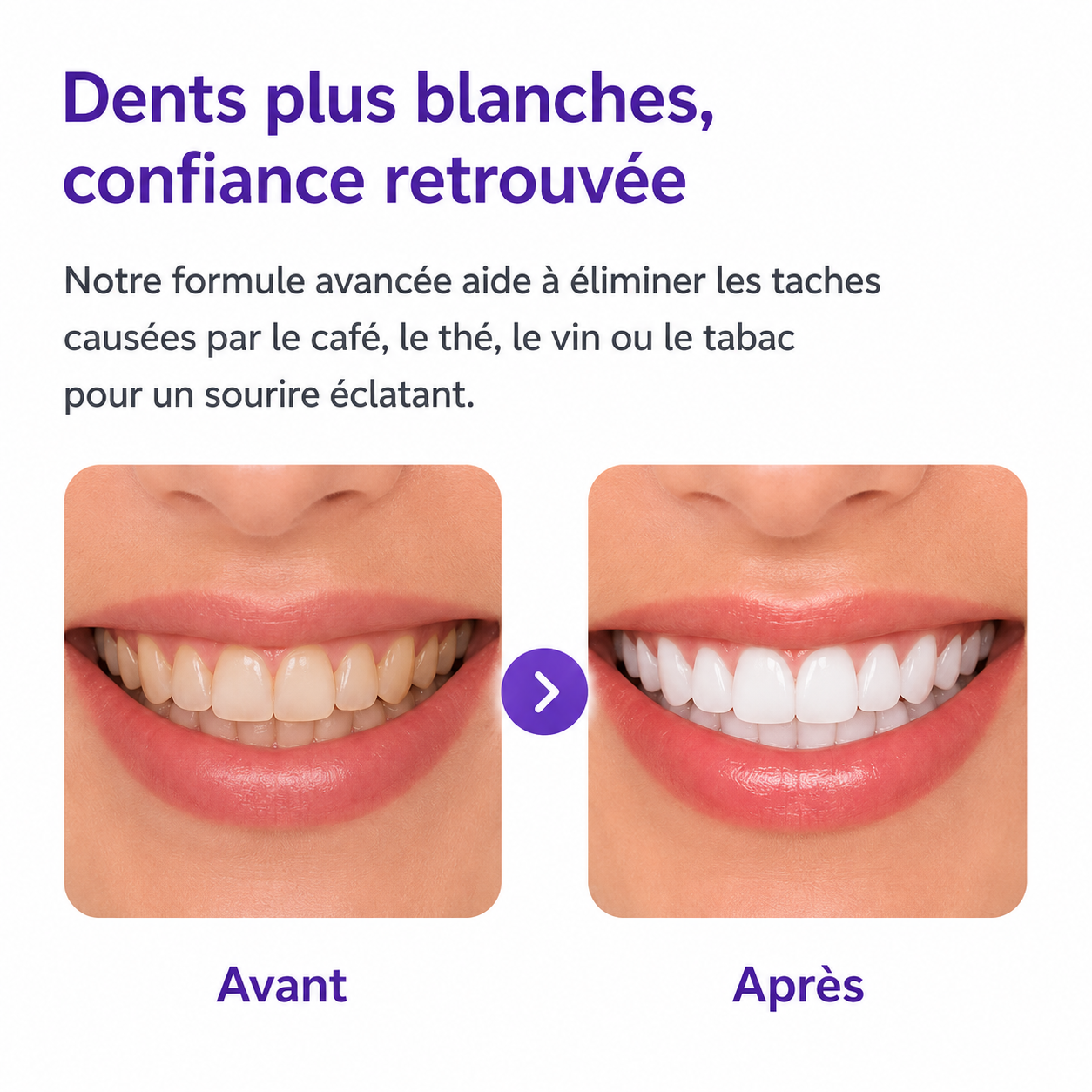 bande blanchissante